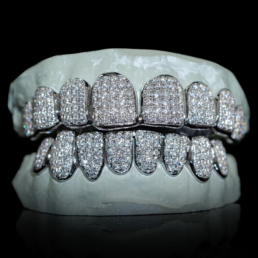 Moissanite Iced Grillz